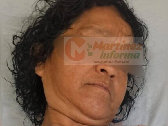 Cae asesina de la apuñalada en Pedernales